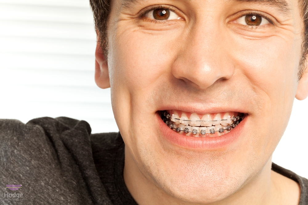 happy young man with metal braces - overbite vs underbite in Little Rock, AR.