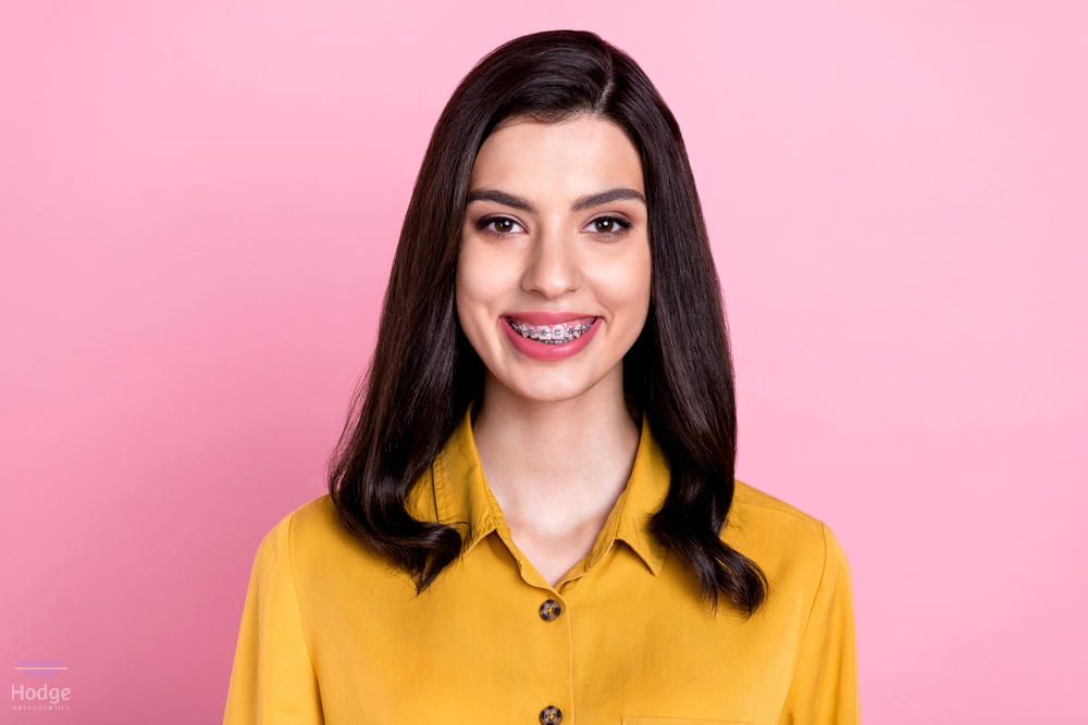 photo of nice optimistic brunette hair young lady wear metal braces - How to Get Braces Glue Off Teeth in Little Rock, AR