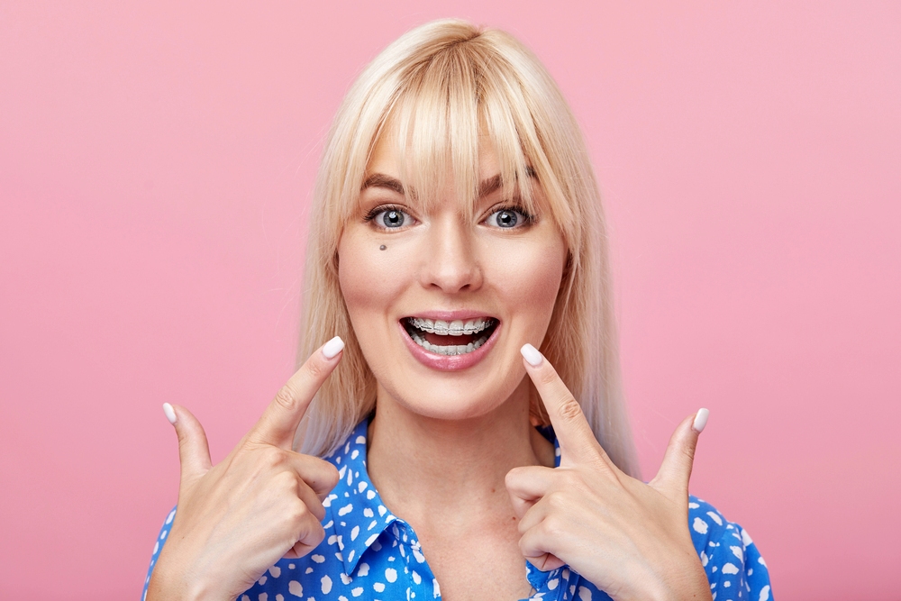 cheerful happy young woman blonde hair gesturing thumb while pointing clear braces - How to Clean Braces in Little Rock, AR